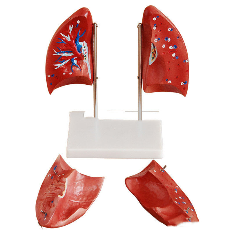 Modelo Anatómico de Pulmones con Segmentos del Sistema Respiratorio