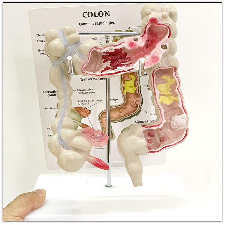 Modelo Anatómico de Intestino Humano