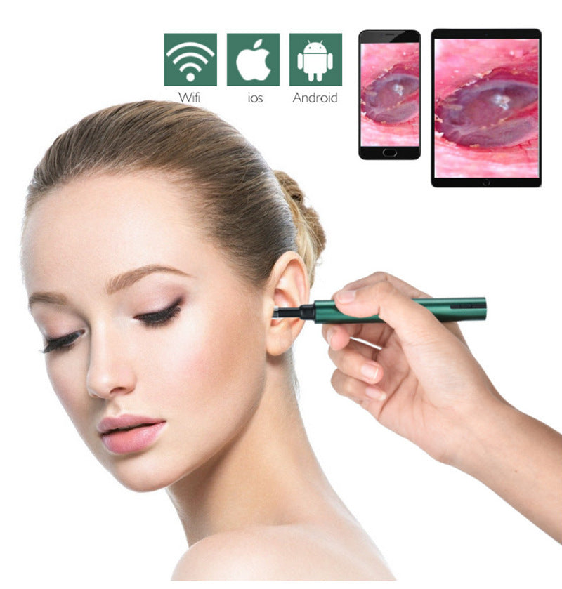 Otoscopio visual inalámbrico WiFi (cámara para oído)