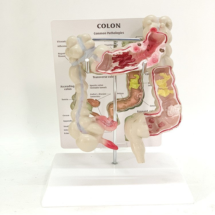 Modelo Anatómico de Intestino Humano