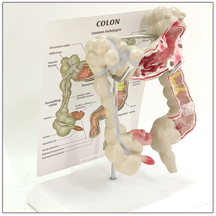 Modelo Anatómico de Intestino Humano