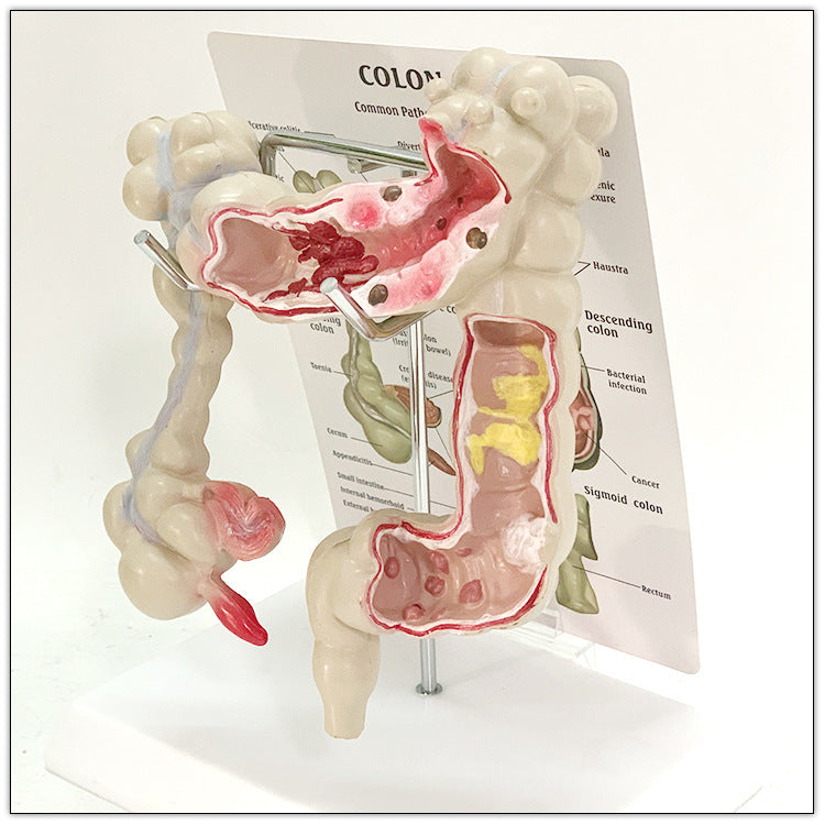 Modelo Anatómico de Intestino Humano