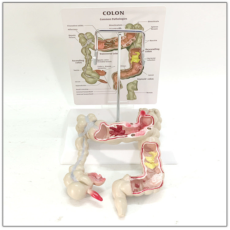 Modelo Anatómico de Intestino Humano