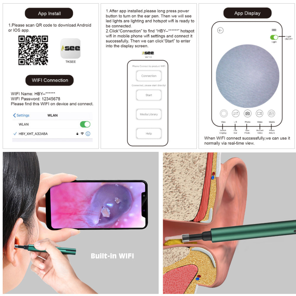 Otoscopio visual inalámbrico WiFi (cámara para oído)
